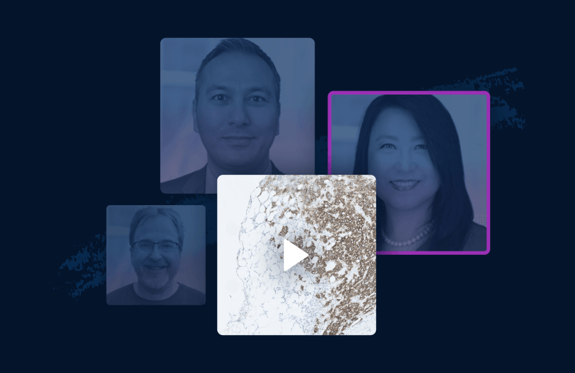 Follow expert-led and guided approaches to HER2 IHC scoring